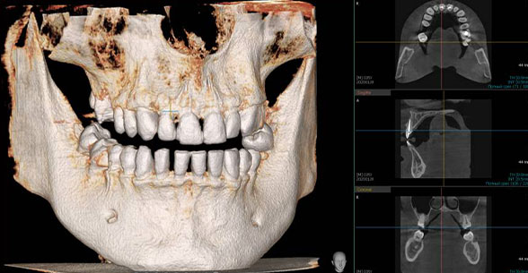 Медилайт сыктывкар. Конусно челюстной снимок. Верблюд зубы рентген.